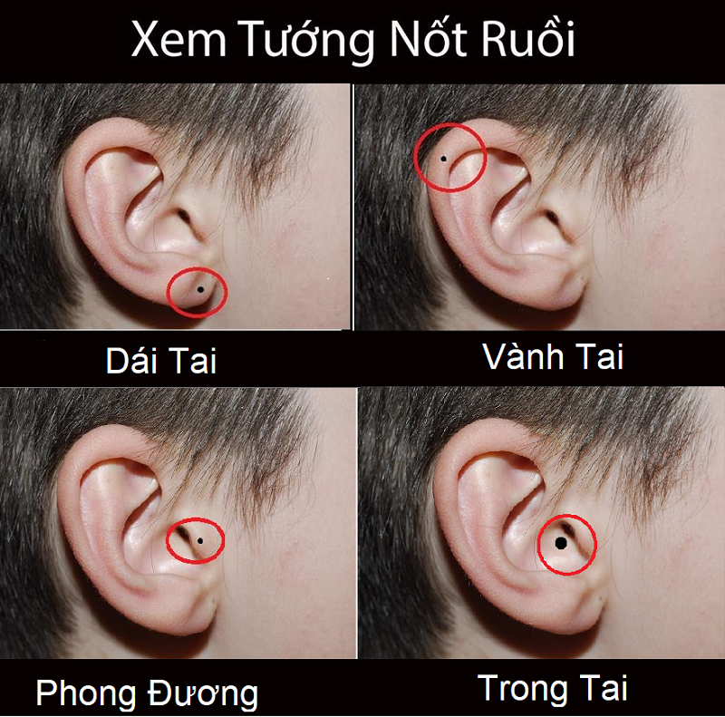 Giải mã ý nghĩa nốt ruồi trên tai phụ nữ và nam giới